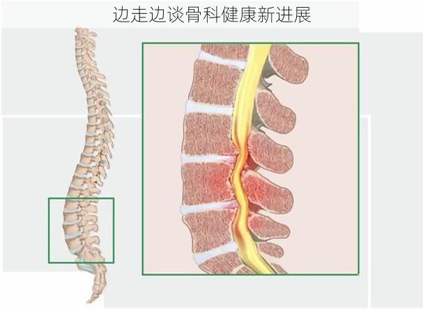 边走边谈骨科健康新进展